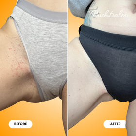 Bushbalm Ingrown Hair Exfoliating Body Scrub Vanilla Tangerine with natural ingredients