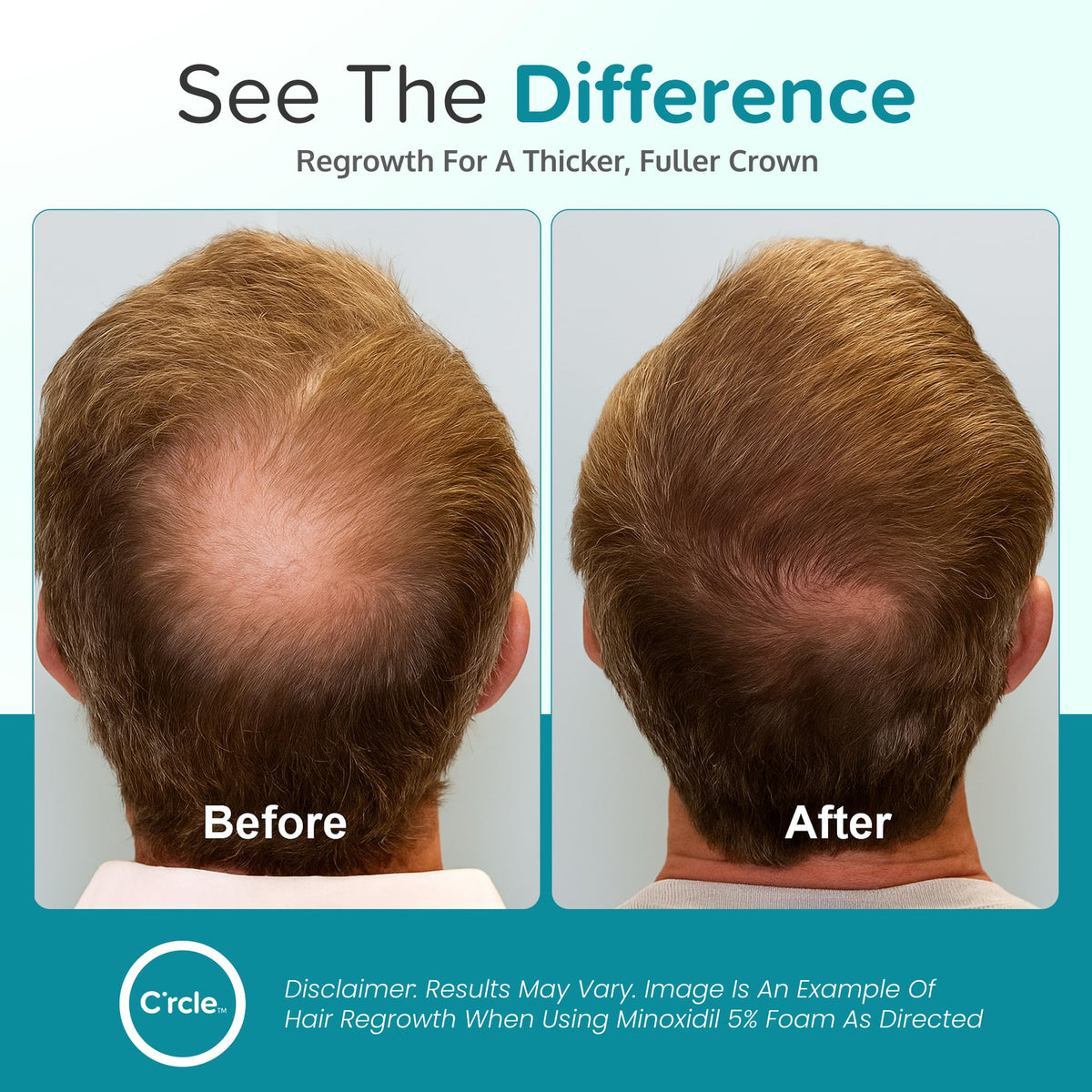 C'rcle Minoxidil Foam 5% bottle top view