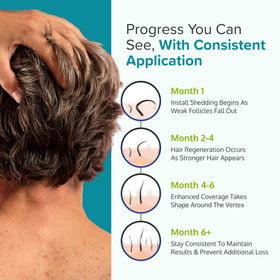 C'rcle Minoxidil Foam 5% for Men with other hair care products