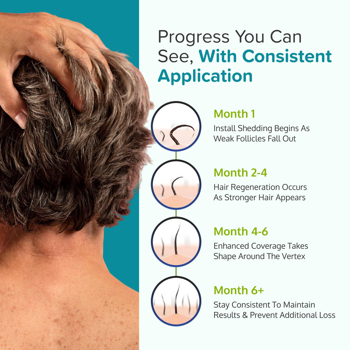 C'rcle Minoxidil Foam 5% lifestyle use