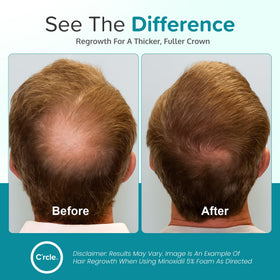 C'rcle Minoxidil Foam 5% product with instructions