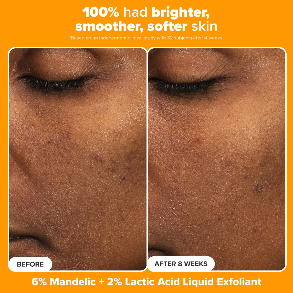 C15 Super support vitamin C serum bottle from Paula's Choice