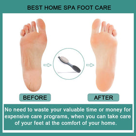 CAREHOOD Foot File complete kit with all components