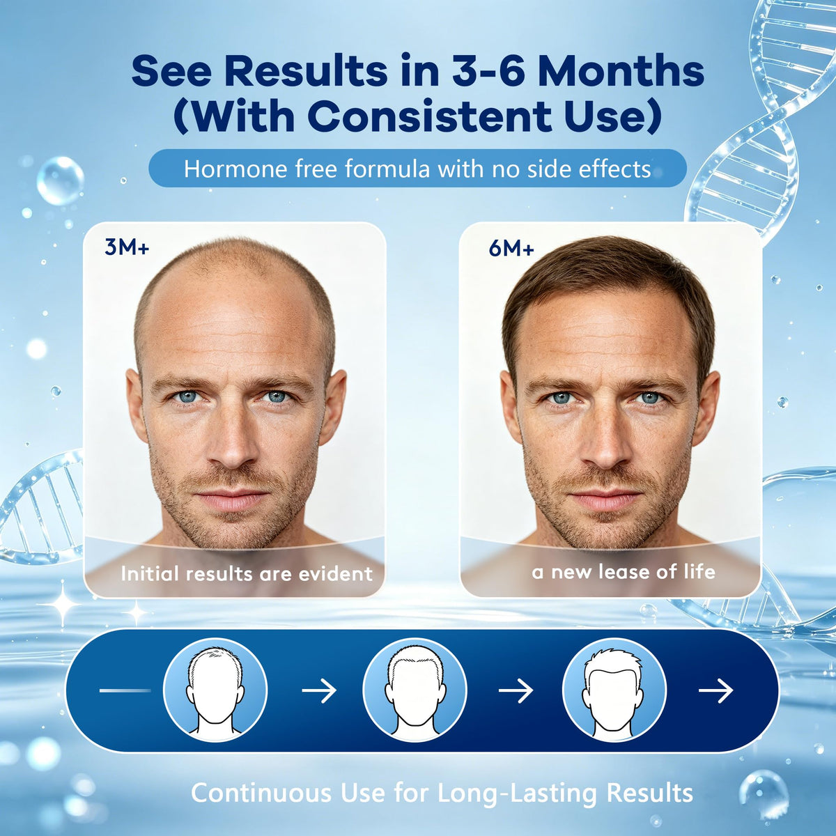 CARENICE Men's 5% Minoxidil Foam lifestyle scene with user