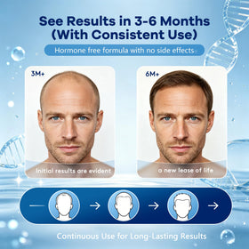 CARENICE Men's 5% Minoxidil Foam lifestyle scene with user