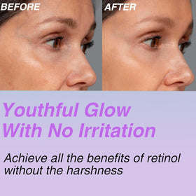 CELDYQUE Bakuchiol Serum 30,000 ppm texture on hand