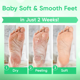 CÉLOR Foot Peel Mask being applied on feet in a relaxing setting