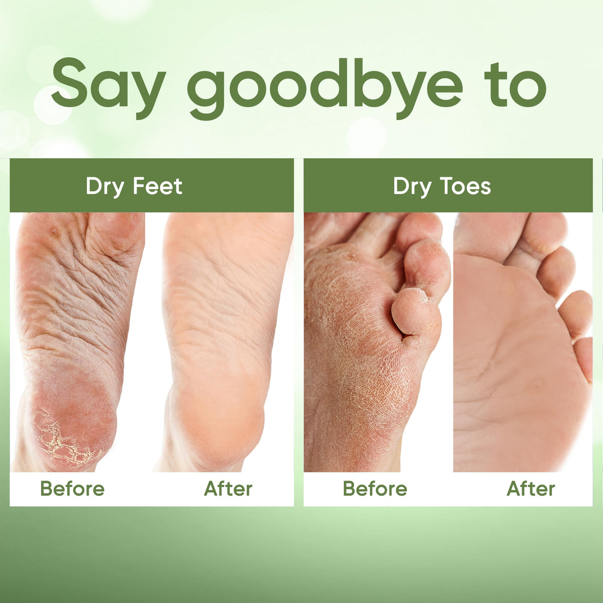 CÉLOR Foot Peel Mask booties close-up showing texture