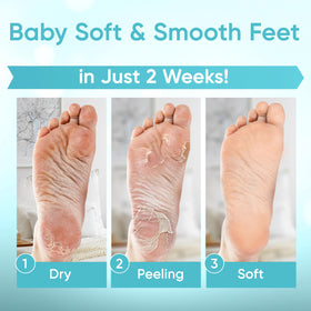 CÉLOR Foot Peel Mask in use on feet with relaxing background