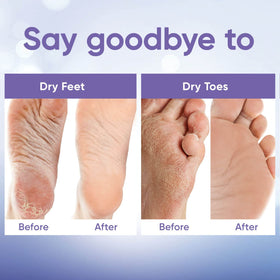 CÉLOR Foot Peeling Mask booties laid out