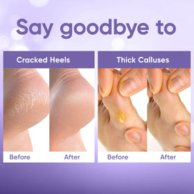 CÉLOR Foot Peeling Mask in a bathroom setting