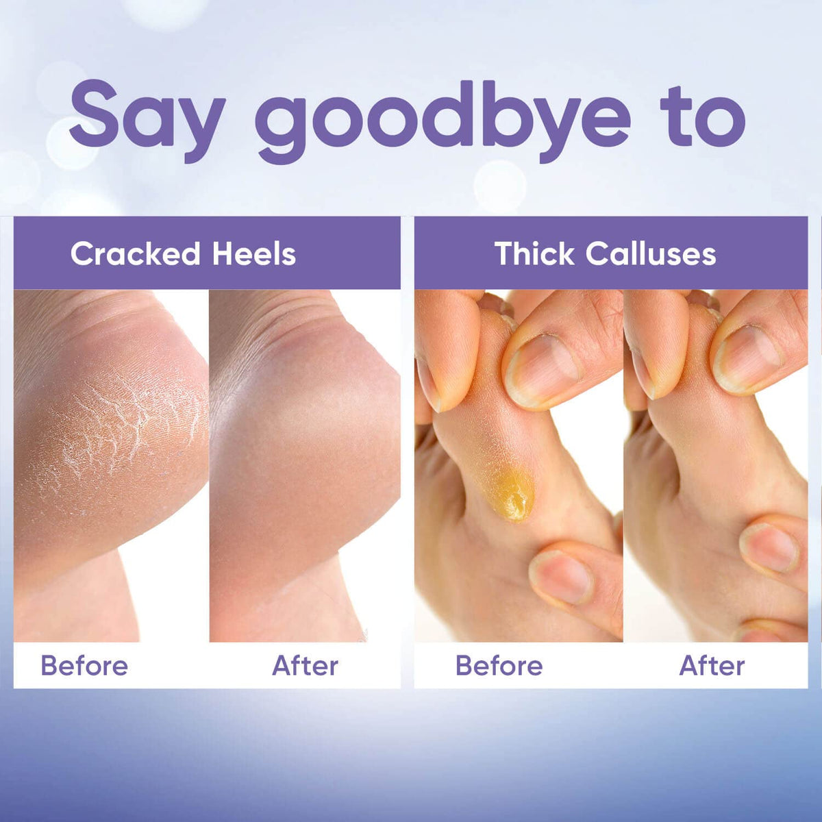 CÉLOR Foot Peeling Mask in a spa setting