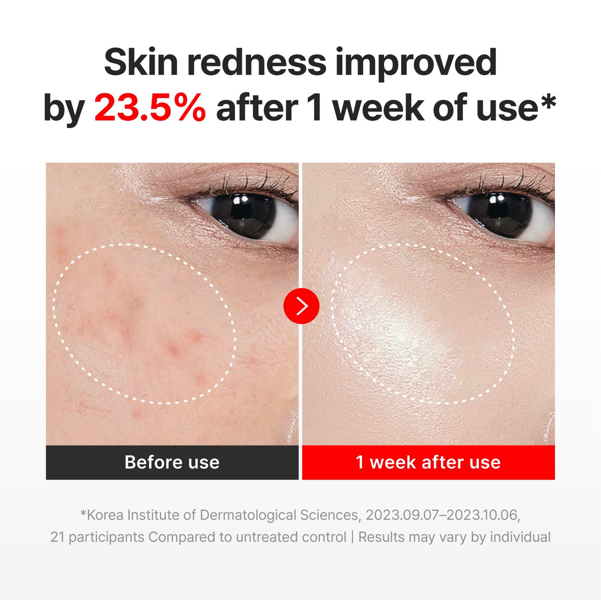 CENTELLIAN 24 Madeca Cream Time Reverse 90g texture close-up