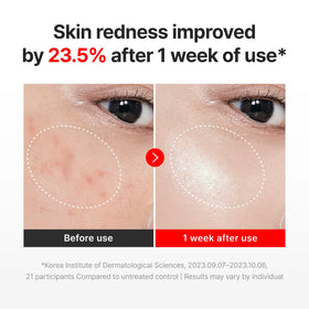 CENTELLIAN 24 Madeca Cream Time Reverse 90g texture close-up