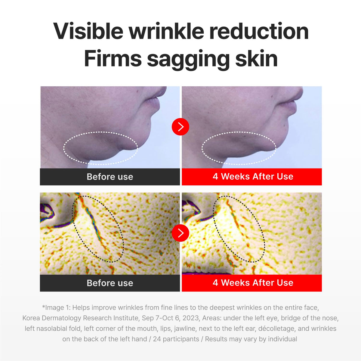 CENTELLIAN 24 Madeca Cream Time Reverse Zero Set in use