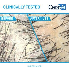 CeraVe 2 In 1 Hydrating Anti Dandruff Shampoo & Conditioner side view