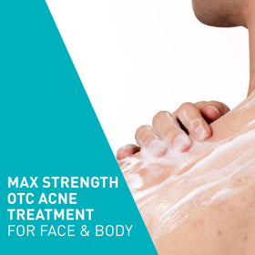 CeraVe Acne Foaming Cream Wash texture close-up