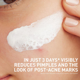 CeraVe Clay to Foam Acne Face Wash 4 Oz side view