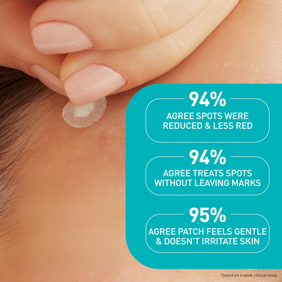 CeraVe Hydrocolloid Pimple Patches in a skincare routine