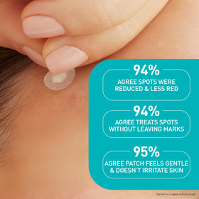 CeraVe Hydrocolloid Pimple Patches in a skincare routine