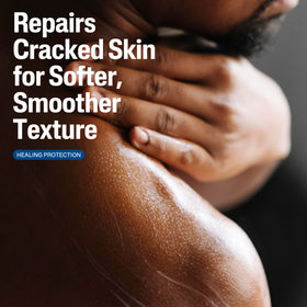 Cetaphil Cracked Skin Repair Lotion texture close-up