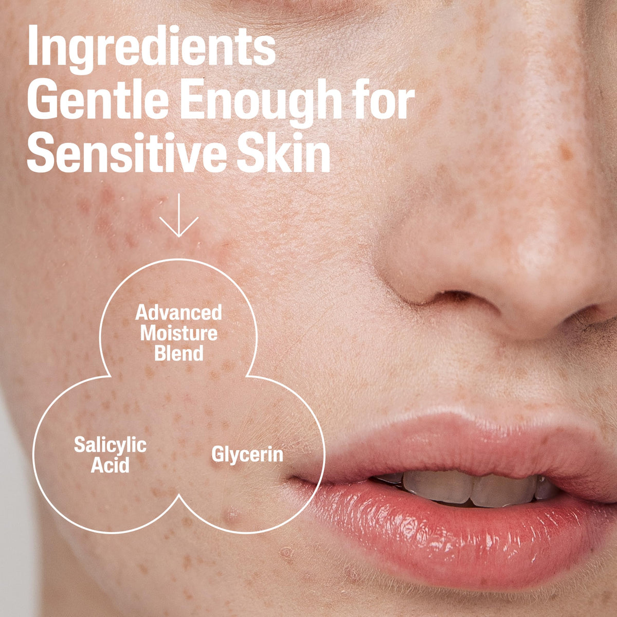 Cetaphil Gentle Clear Acne Foaming Face Wash ingredients list