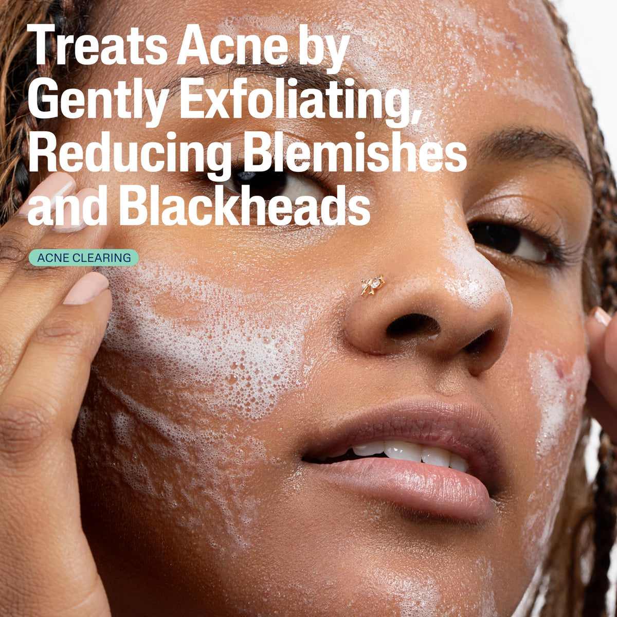 Cetaphil Gentle Clear Acne Foaming Face Wash texture close-up
