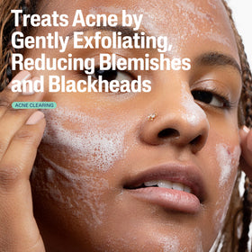 Cetaphil Gentle Clear Acne Foaming Face Wash texture close-up