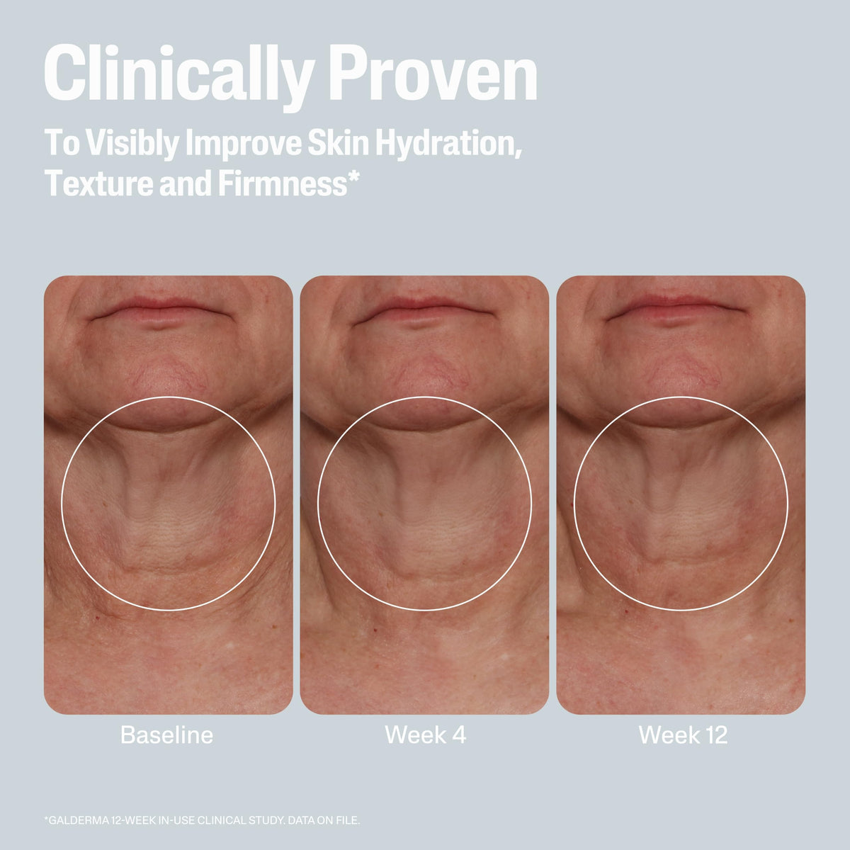 Cetaphil Skin Activator Firming Body Cream application on skin