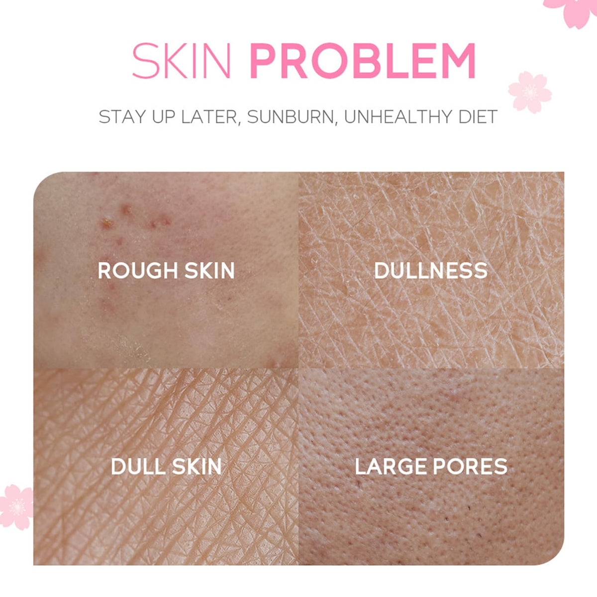 Cherry blossom eye cream from MrCuvaryas Sakura Skin Care Set