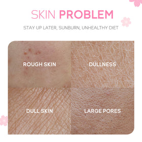 Cherry blossom eye cream from MrCuvaryas Sakura Skin Care Set