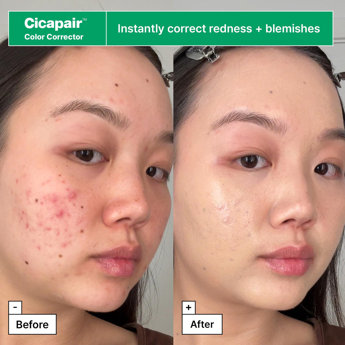 Cicapair Sensitive Skin Moisturizer for Redness tube