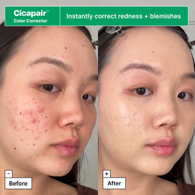 Cicapair Sensitive Skin Moisturizer for Redness tube