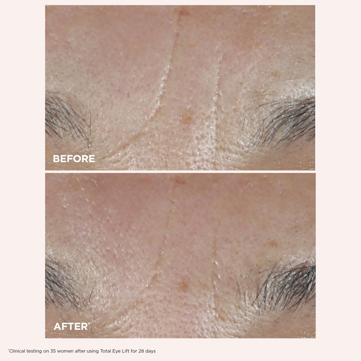 CLARINS Total Eye Lift being applied around eyes