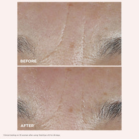 CLARINS Total Eye Lift being applied around eyes