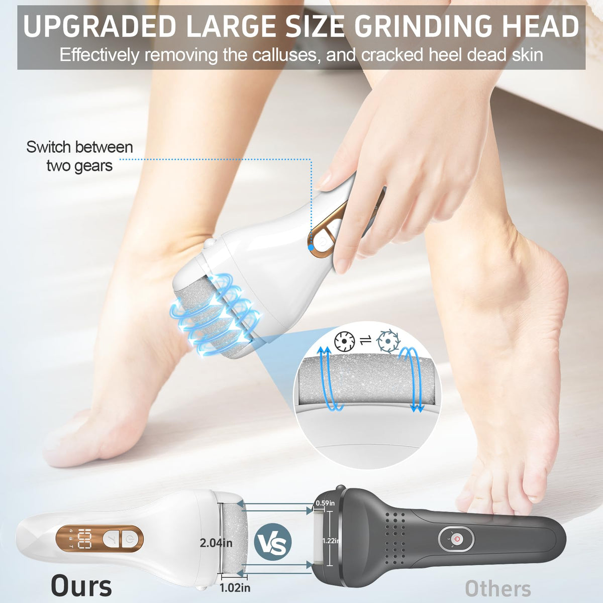 Close-up of AdamPark callus remover showing stainless steel files