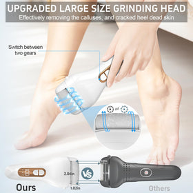 Close-up of AdamPark callus remover showing stainless steel files