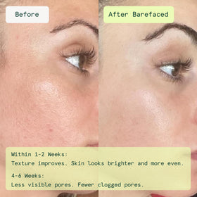 Close-up of Barefaced Toning and Exfoliating Pad showing texture