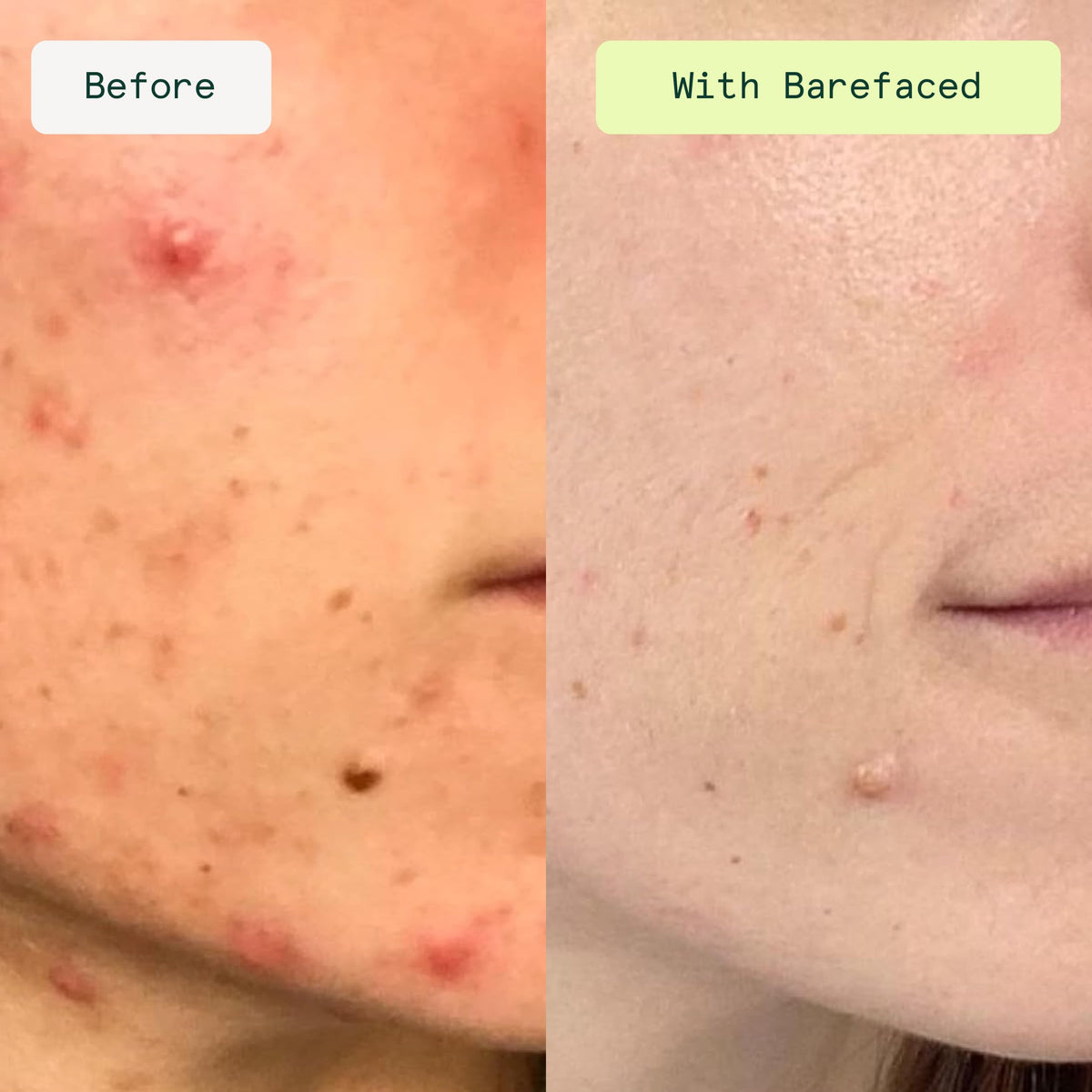 Close-up of Barefaced Toning Pads II showing individual pad