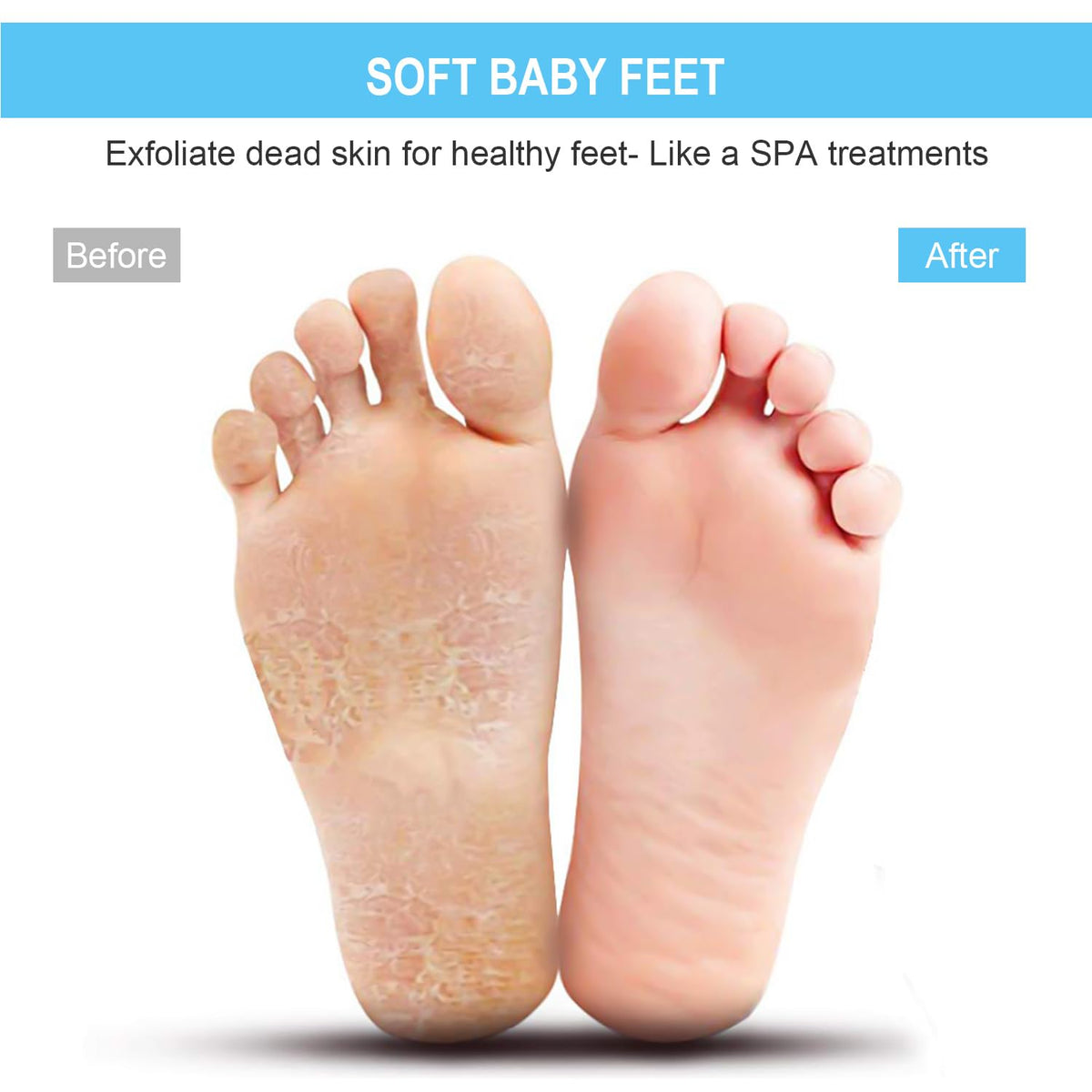 Close-up of BESKAR foot scrubber mat suction cups
