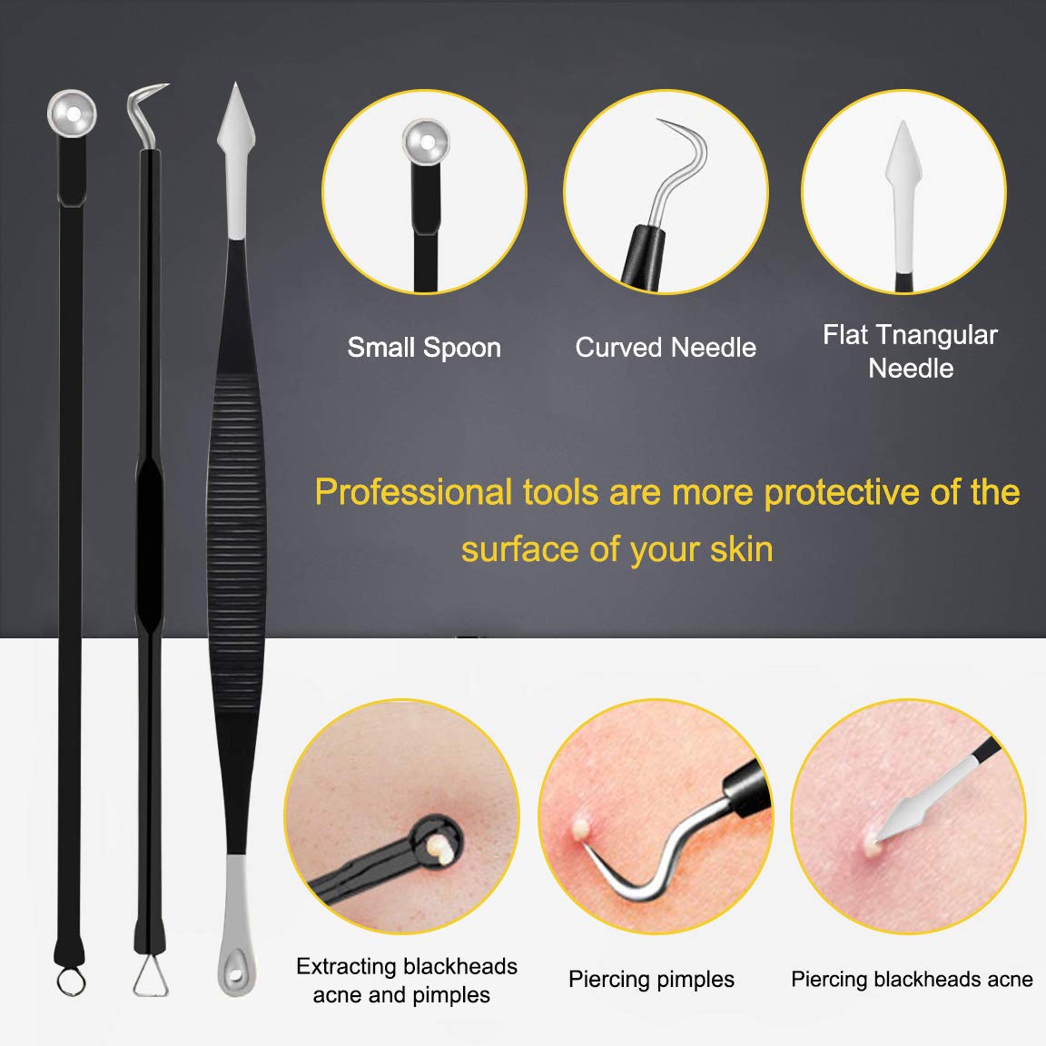 Close-up of Boxoyx stainless steel pimple extractor