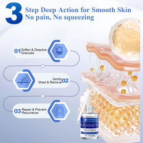 Close-up of BYT BANGYTONG Milia Remover Serum texture on skin