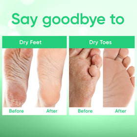 Close-up of CÉLOR Foot Peel Mask booties with texture detail