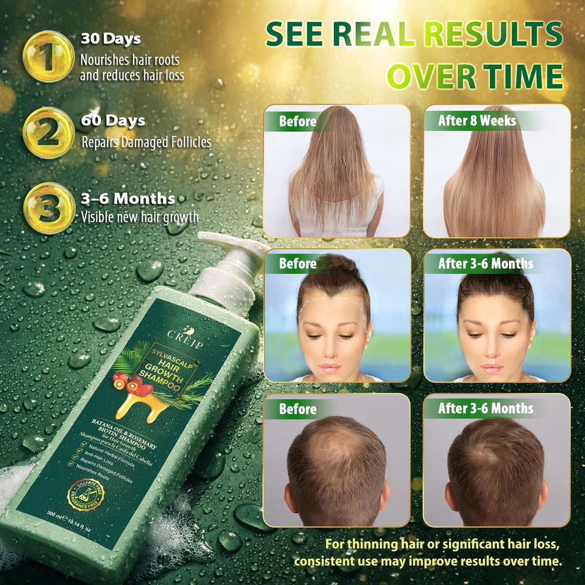 Close-up of Creip Rosemary & Batana Oil Hair Growth Shampoo cap