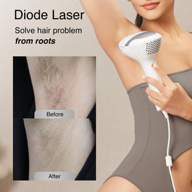 Close-up of DermRays V8S laser technology