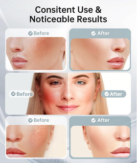 Close-up of Dopsikn facial massager controls