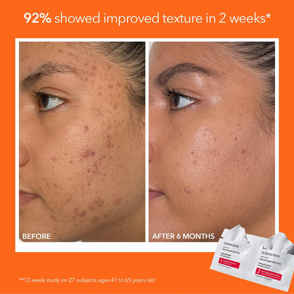 Close-up of Dr Dennis Gross skincare products