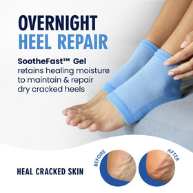 Close-up of Dr. Frederick's heel socks showing the open-toe design