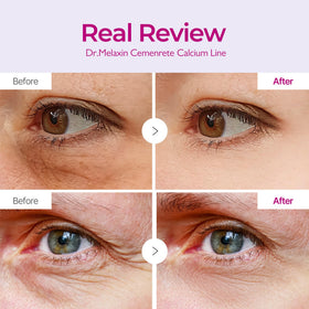 Close-up of Dr.Melaxin Hydrogel Eye Mask texture