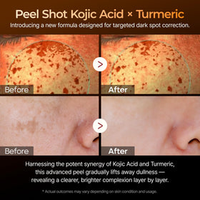 Close-up of Dr.Melaxin Kojic Acid Turmeric Serum texture